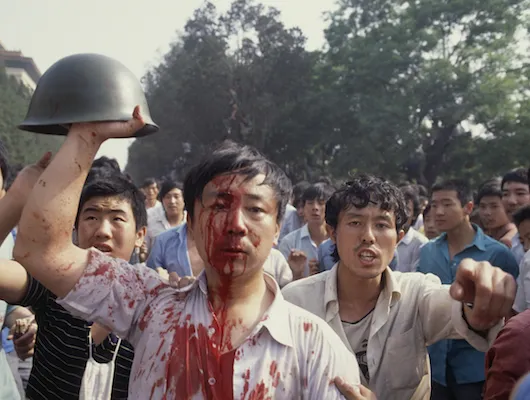 Man with bloodied face holding up helmet from a soldier